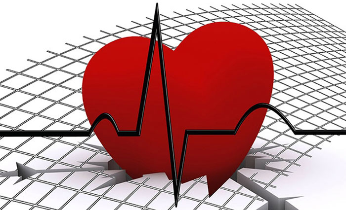 Omocisteina e rischio di malattie cardiovascolari
