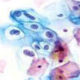 Thin Prep Pap Test – L’Evoluzione del Pap test